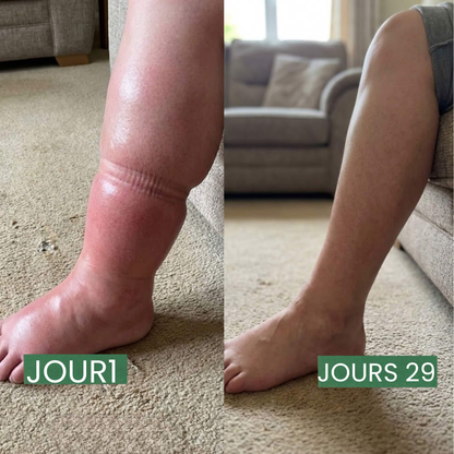 Drainage Lymphatique Naturel